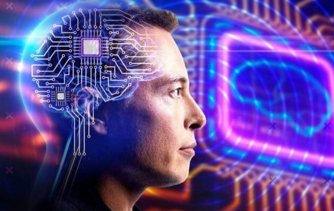 Первый пациент Neuralink ожидает второй имплант для восстановления способности ходить